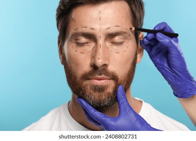 Doctor with pencil preparing patient for cosmetic surgery operation on light blue background, closeup - Powered by Shutterstock