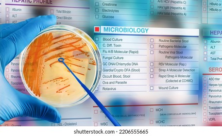 Doctor With Petri Plate Culture And Microbiological Test Petition Form. Microbiologist Holding Petri Dish With Streptococcus Agalactiae Bacterial Colonies On A Digital Microbiology Test Request Form