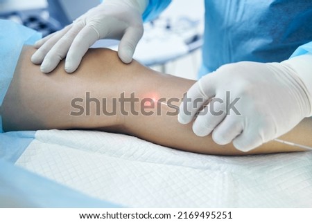 Doctor phlebologist is performing endovenous laser treatment