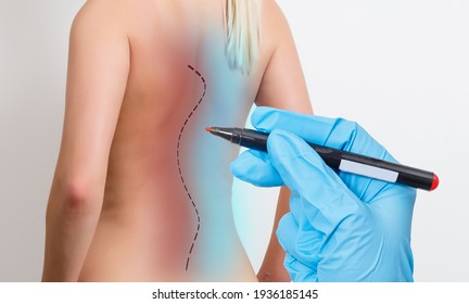 Doctor Plastic Surgeon Marks With A Felt-tip Pen A Marker For A Surgical Operation To Remove Fat On The Abdomen Of A Girl. The Concept Of The Modern Procedure In Plastic Surgery Abdominoplasty