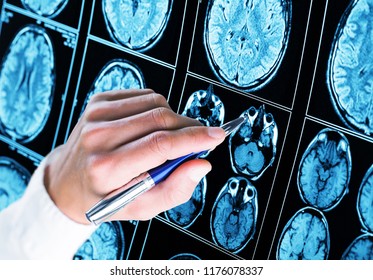 Doctor pointing with pen to the brain - Shutterstock ID 1176078337