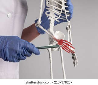 Doctor Pointing To Skeleton Hand With Red Point. Fingers Pain. Skeletal System Anatomy, Medical Education Concept. Woman In Lab Coat With Stethoscope Holding Pencil. High Quality Photo