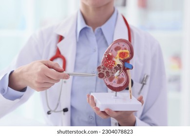 Doctor points pen to artificial model of kidney with stones in premise. Specialist demonstrates structure and diseases of human for students at lesson