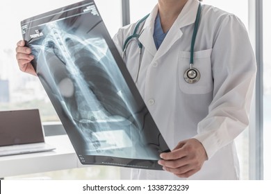 Doctor With Radiological Chest X-ray Film For Medical Diagnosis On Patient’s Health On Asthma, Lung Disease And Bone Cancer Illness