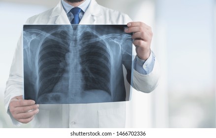 Doctor with radiological chest x-ray film for medical diagnosis on patient health on asthma, lung disease and bone cancer illness, healthcare hospital service concept 