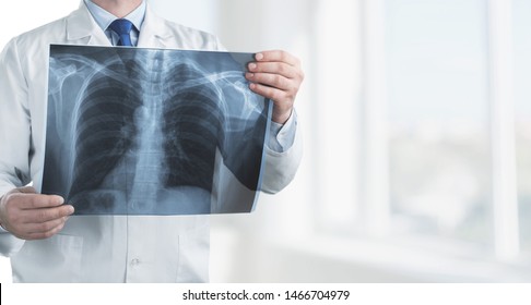 Doctor With Radiological Chest X-ray Film For Medical Diagnosis On Patient Health On Asthma, Lung Disease And Bone Cancer Illness, Healthcare Hospital Service Concept 
   