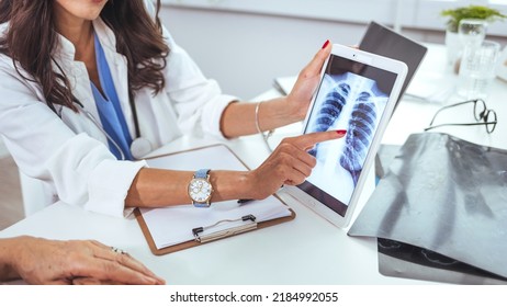 Doctor With Radiological Chest X-ray Film For Medical Diagnosis On Patient's Health On Asthma, Lung Disease And Bone Cancer Illness. Lung Cancer Medical. Doctor Explaining Results Of Lung Check Up 