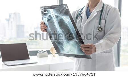 Doctor with radiological chest x-ray film for medical diagnosis on patient’s health on COVID-19, asthma, lung disease and bone cancer illness, healthcare hospital service concept 