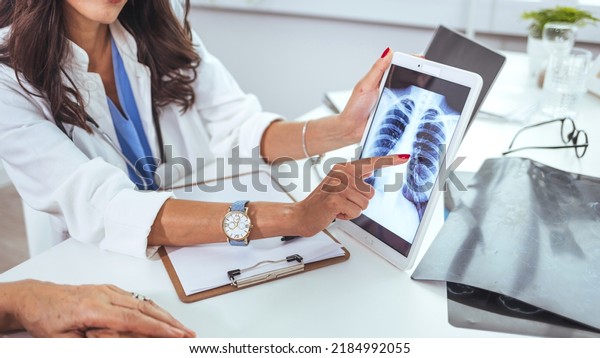 Doctor with radiological chest x-ray film for medical\
diagnosis on patient\'s health on asthma, lung disease and bone\
cancer illness. Lung cancer medical. Doctor explaining results of\
lung check up 