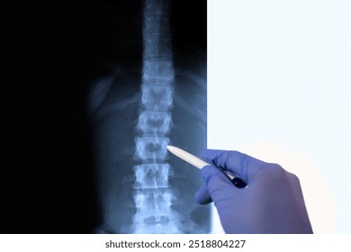 Doctor radiologically analyzing the human spinal column with x-ray.
Hand of a doctor analyzing and pointing with a pen to the affected area.                                                         - Powered by Shutterstock