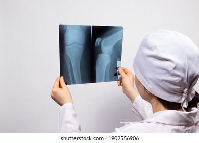 A doctor or radiologist holds an X-ray of a person's leg - knee, knee injury. Diagnosis of fractures or bone fractures.