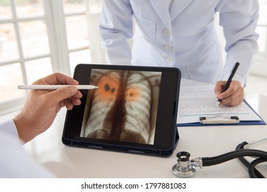 Doctor Or Radiologist Looking At Patient Chest X-ray Images On Screen Laptop For Diagnose Disease Pneumonia Or Lung Inflamed.