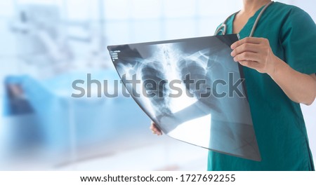 doctor radiology looking chest x-ray film of patient at hospital.