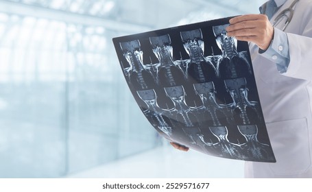 Doctor radiology or surgeon check cervical spine x-ray film by ct scan and mri scan of Cervical Spine Osteoarthritis patient. - Powered by Shutterstock