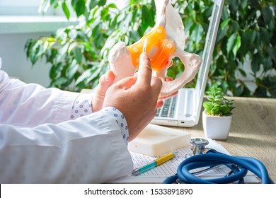 The Doctor At The Reception Holds The Scalpel Over The Anatomical Model Of The Hip Joint And Shows The Patient Or Colleagues How Hip Replacement Operation Will Be Performed On Orthopedic Surgery