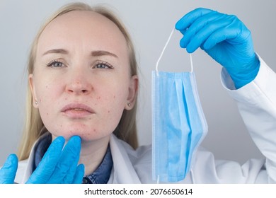 Doctor Removes The Protective Mask And Shows Irritation On Face Skin. Antiviral Measures. Means Of Protection Against Covid 19. Long Wearing Of A Mask. Acne On Face And Chafing. Dry Lips And Red Dots