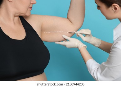 Doctor With Scalpel Near Obese Woman On Light Blue Background, Closeup. Weight Loss Surgery