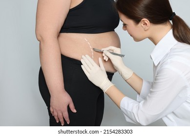 Doctor With Scalpel Near Obese Woman On Light Background. Weight Loss Surgery