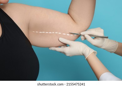 Doctor With Scalpel Near Obese Woman On Light Blue Background, Closeup. Weight Loss Surgery