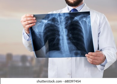 Doctor Looking Medical Radiological Xray Photograph Stock Photo (Edit ...