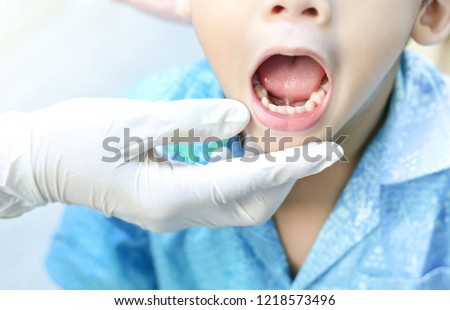 doctor screening and diagnosis mouth of tongue-tie patient , dental health problem, children show tongue and teeth