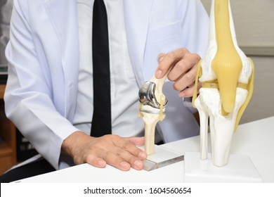 The Doctor Showing A Model Of Knee Joint After Total Knee Replacement Surgery.