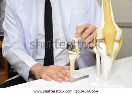 The doctor showing a model of knee joint after total Knee Replacement surgery.