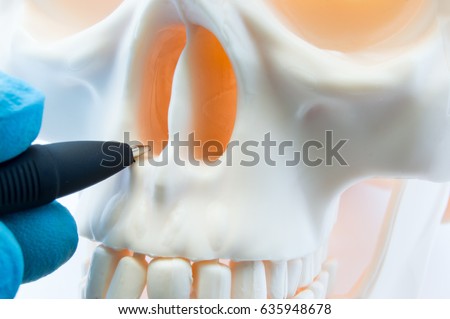 Doctor showing patient bone anatomy of skeleton of nose and nasal cavity on skull. Preparing for rhinoplasty surgery, correcting deviated nasal septum, localization of rhinitis, sinusitis in nose