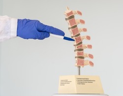 The Doctor Shows A Model Of The Human Spine, Which Shows Various Defects In The Vertebrae. Inscriptions On The Model: 1-Compression Fracture, 2-Normal Vertebral, 3-Osteoporotic Bone, 4-Wedge Fracture.