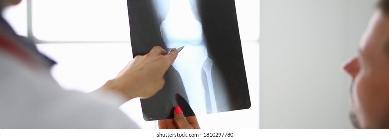 Der Arzt zeigt eine Röntgenaufnahme des Patienten, Nahaufnahme. Untersuchung des Knochen- und Gelenkkonzepts
