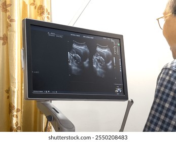 Doctor Smiling While Reviewing Ultrasound Results During a Prenatal Checkup. Pregnancy, Maternity, and Fertility Concept. Expectant Mother Monitoring Her Baby's Development. - Powered by Shutterstock