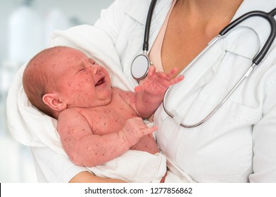 Doctor With Stethoscope Holding A Newborn Baby Which Is Sick Rubella Or Measles