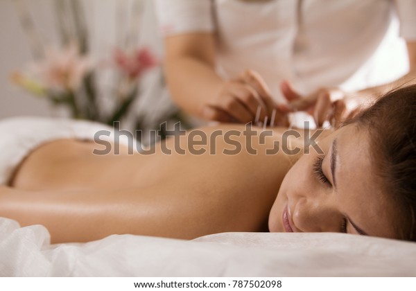 The doctor sticks needles into the girl\'s body\
on the acupuncture - close\
up