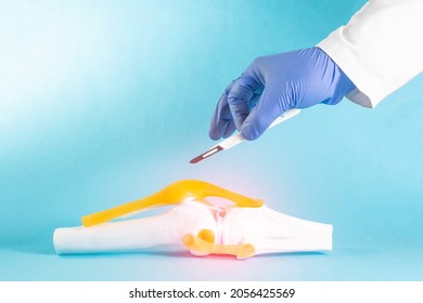 Doctor surgeon holds a scalpel near the knee joint mockup on a blue background. Concept knee surgery, cruciate ligament replacement, meniscus surgery. Copy space for text, orthopedics