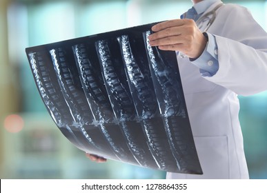 doctor surgeon look at spine x-ray film of patient at operating room. - Powered by Shutterstock