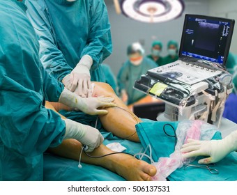 Doctor surgery foot Suture,Percutaneous transluminal angioplasty ,Vascular bypass blood vessel graft surgery ,leg ,medical Operating Room in hospital  