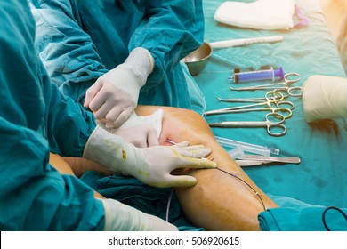 Doctor surgery foot Suture,Percutaneous transluminal angioplasty ,Vascular bypass blood vessel graft surgery ,leg ,Medical Operating Room in hospital  
