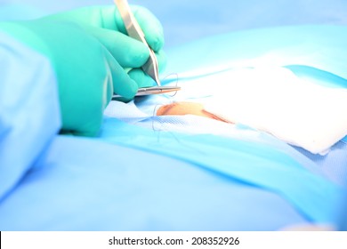 Doctor suturing an hernia.  Focus in the tools