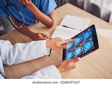 Doctor, tablet and brain xray, neurology and digital test results, people and healthcare team in hospital. MRI, technology and screen in hands, cancer and radiology, anatomy and health assessment - Powered by Shutterstock