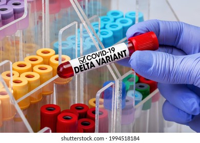 Doctor testing with blood test tube from patient infected with Coronavirus Delta variant. Doctor epidemiologist holding blood tube for test detection of virus Covid-19 Delta Variant with positive resu