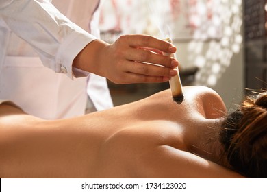 The Doctor Of Traditional Chinese Medicine To The Patient Moxibustion