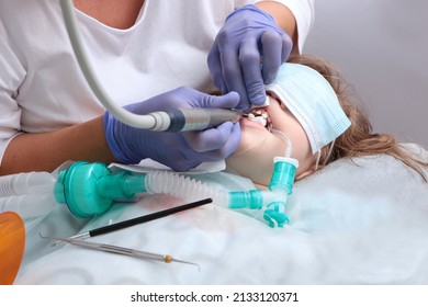 A Doctor Treats Baby Teeth In A Child. Treatment Of Baby Teeth Under Anesthesia. Dental Surgery Under Anesthesia. Breathing Tube. Open Mouth. Baby Teeth.