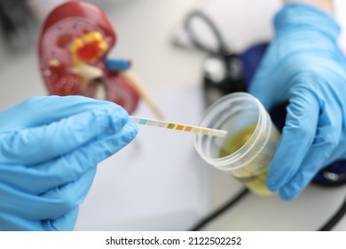 Doctor Urologist Making Express Urine Test Using Indicator Paper Closeup