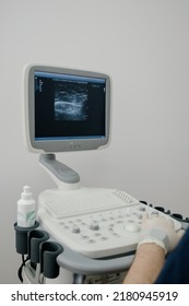 The Doctor Uses An Ultrasound Device To Study The Condition Of The Veins.Modern Ultrasound Monitor. Ultrasonography Machine. High Technology Medical And Healthcare Equipment.