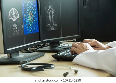 Doctor Using Computer To Analyze MRI Brain Picture In Radiology Room Of The Hospital