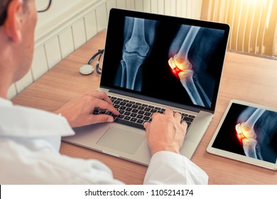 Doctor watching a laptop with x-ray with pain relief on a knee in a medical office in the morning light