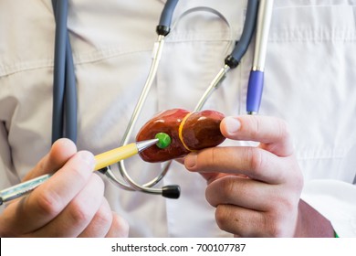 Doctor in white medical lab coat points ballpoint pen on anatomical model of human or animal gallbladder. Concept photo for use for study of anatomy of gallbladder and liver,  medicine, veterinary