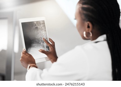 Doctor, x ray and back in hospital with tablet, examining and digital healthcare or spine anatomy with medical professional. Fracture, skeleton review and assessment for patient, radiology and woman - Powered by Shutterstock