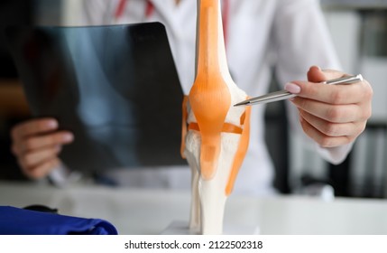 Doctor with xray in his hands showing structure of knee joint on artificial model closeup