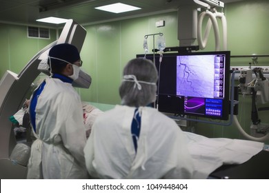 Doctors conduct a diagnostic operation. Coronarography. Percutaneous coronary intervention-recanalization, balloon angioplasty and stenting of the left coronary artery